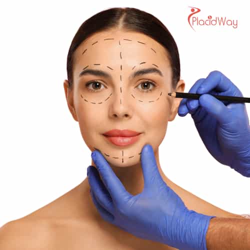 V-образная челюстная пластика в Южной Корее для достижения гармонии и контурной коррекции лица, к которым стремятся пациенты.